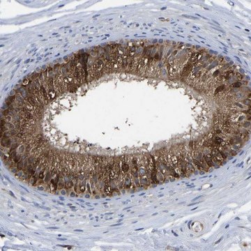 Anti-FRRS1 antibody produced in rabbit Prestige Antibodies&#174; Powered by Atlas Antibodies, affinity isolated antibody, buffered aqueous glycerol solution