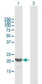 Anti-RP4-691N24.2 antibody produced in mouse purified immunoglobulin, buffered aqueous solution
