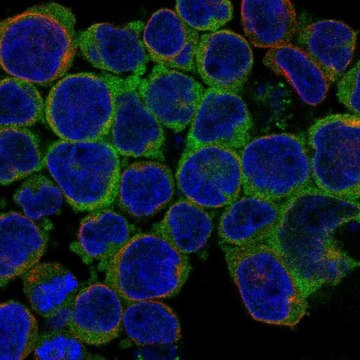 Anti-Ubash3B Antibody Produced In Rabbit Prestige Antibodies&#174; Powered by Atlas Antibodies, affinity isolated antibody, buffered aqueous glycerol solution