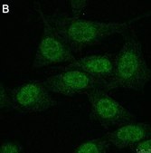 Anti-FoxP3 Antibody, clone 4J2 ZooMAb® Rabbit Monoclonal recombinant, expressed in HEK 293 cells