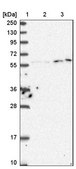 Anti-KPNA3 antibody produced in rabbit Prestige Antibodies® Powered by Atlas Antibodies, affinity isolated antibody, buffered aqueous glycerol solution