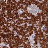Anti-SSR4 antibody produced in rabbit affinity isolated antibody, buffered aqueous glycerol solution