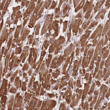 Anti-TRIM3 antibody produced in rabbit Prestige Antibodies&#174; Powered by Atlas Antibodies, affinity isolated antibody, buffered aqueous glycerol solution