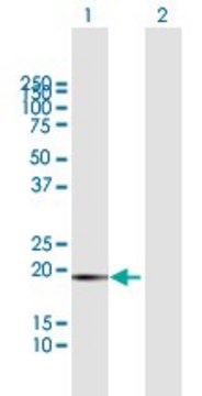 Anti-FTL antibody produced in mouse purified immunoglobulin, buffered aqueous solution