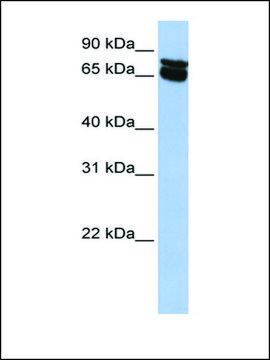 Anti-B4GALNT1 antibody produced in rabbit affinity isolated antibody