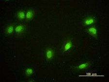 Monoclonal Anti-CRY1 antibody produced in mouse clone 4H4-1C4, purified immunoglobulin, buffered aqueous solution