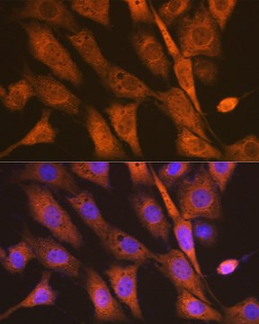 Anti-PEN2/PSENEN Antibody, clone 6J5O4, Rabbit Monoclonal