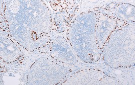 p63 (EP174) Rabbit Monoclonal Primary Antibody