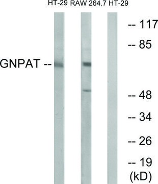 Anti-GNPAT antibody produced in rabbit affinity isolated antibody