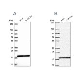 Anti-RPS15 antibody produced in rabbit Prestige Antibodies® Powered by Atlas Antibodies, affinity isolated antibody, buffered aqueous glycerol solution