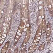 Anti-DNAJB1 antibody produced in rabbit Prestige Antibodies® Powered by Atlas Antibodies, affinity isolated antibody, buffered aqueous glycerol solution