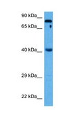 Anti-FOXA3 affinity isolated antibody