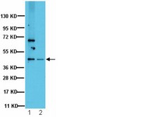 Anti-Protein Phosphatase 2 C α/β Antibody from rabbit