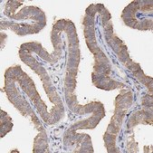 Anti-STON2 antibody produced in rabbit Prestige Antibodies® Powered by Atlas Antibodies, affinity isolated antibody, buffered aqueous glycerol solution