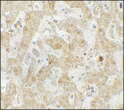 Anti-CCR7 antibody produced in rabbit affinity isolated antibody