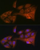 Anti-HE4/WFDC2 antibody produced in rabbit