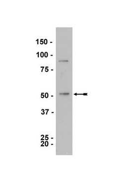 Anti-LKB1 Antibody, clone 5c10 clone 5c10, Upstate&#174;, from mouse