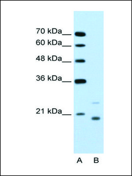 Anti-UBE2D1 antibody produced in rabbit IgG fraction of antiserum