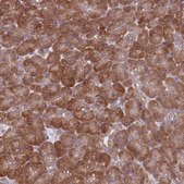 Anti-TMC4 antibody produced in rabbit Prestige Antibodies® Powered by Atlas Antibodies, affinity isolated antibody, buffered aqueous glycerol solution