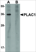 Anti-PLAC1 antibody produced in rabbit affinity isolated antibody, buffered aqueous solution