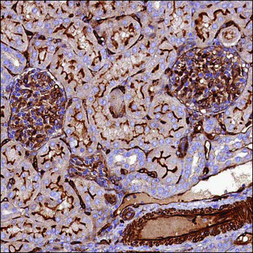 Anti-CCBE1 antibody produced in rabbit Prestige Antibodies&#174; Powered by Atlas Antibodies, affinity isolated antibody, buffered aqueous glycerol solution