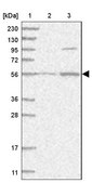 Anti-HACL1 antibody produced in rabbit Prestige Antibodies® Powered by Atlas Antibodies, affinity isolated antibody, buffered aqueous glycerol solution