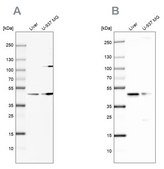 Anti-GCDH antibody produced in rabbit Prestige Antibodies® Powered by Atlas Antibodies, affinity isolated antibody, buffered aqueous glycerol solution
