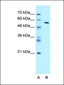 Anti-CES1 (AB1) antibody produced in rabbit IgG fraction of antiserum