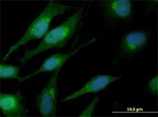 Monoclonal Anti-CTNNB1 antibody produced in mouse clone 1C9, purified immunoglobulin, buffered aqueous solution