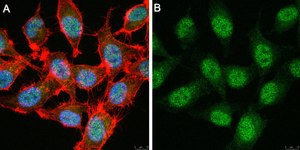 Anti-TCF-4 Antibody, clone 1G4 ZooMAb® Rabbit Monoclonal recombinant, expressed in HEK 293 cells
