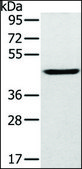 Anti-SLC16A8 antibody produced in rabbit affinity isolated antibody