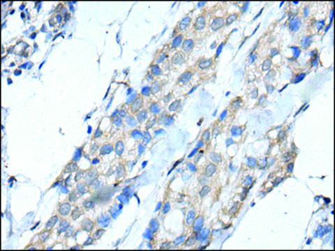 Anti-SCNN1G affinity isolated antibody