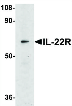 Anti-IL-22 Receptor antibody produced in rabbit affinity isolated antibody, buffered aqueous solution