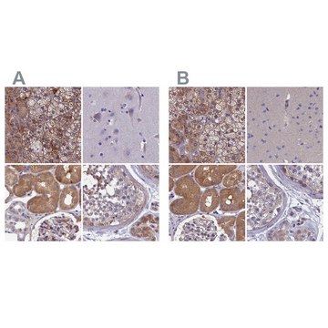 Anti-AMDHD2 antibody produced in rabbit Prestige Antibodies&#174; Powered by Atlas Antibodies, affinity isolated antibody, buffered aqueous glycerol solution