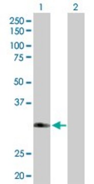 Anti-FBXO6 antibody produced in rabbit purified immunoglobulin, buffered aqueous solution