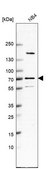 Anti-ANKRD55 antibody produced in rabbit Prestige Antibodies® Powered by Atlas Antibodies, affinity isolated antibody, buffered aqueous glycerol solution