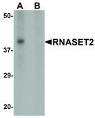 Anti-RNASET2 antibody produced in rabbit affinity isolated antibody