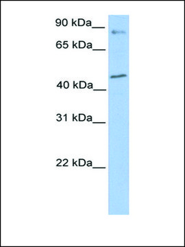 Anti-POLK antibody produced in rabbit affinity isolated antibody