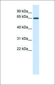 Anti-AMH antibody produced in rabbit affinity isolated antibody