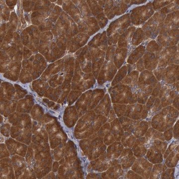 Anti-USP14 antibody produced in rabbit Prestige Antibodies&#174; Powered by Atlas Antibodies, affinity isolated antibody, buffered aqueous glycerol solution