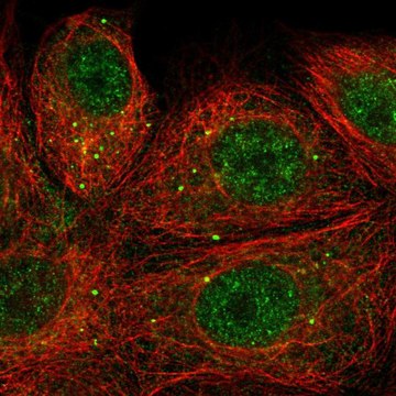 Anti-SEMA3E antibody produced in rabbit Prestige Antibodies&#174; Powered by Atlas Antibodies, affinity isolated antibody