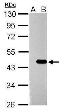 Anti-ZBTB24 antibody produced in rabbit affinity isolated antibody, buffered aqueous solution