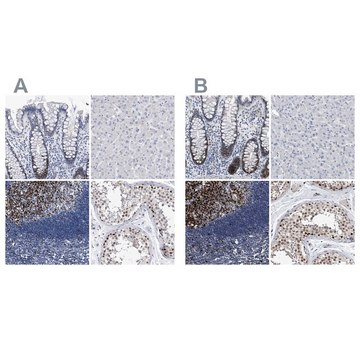 Anti-PCNA antibody produced in rabbit Prestige Antibodies&#174; Powered by Atlas Antibodies, affinity isolated antibody, buffered aqueous glycerol solution, ab3