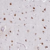 Anti-DPF1 antibody produced in rabbit Prestige Antibodies® Powered by Atlas Antibodies, affinity isolated antibody, buffered aqueous glycerol solution