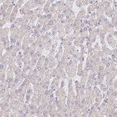 Anti-WDR62 antibody produced in rabbit Prestige Antibodies® Powered by Atlas Antibodies, affinity isolated antibody, buffered aqueous glycerol solution