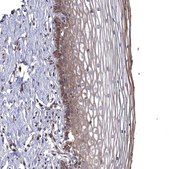 Anti-WDR19 antibody produced in rabbit Prestige Antibodies® Powered by Atlas Antibodies, affinity isolated antibody, buffered aqueous glycerol solution