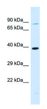 Anti-RHBDL2 (N-terminal) antibody produced in rabbit affinity isolated antibody