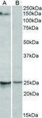 Anti-RBM20 antibody produced in goat affinity isolated antibody, buffered aqueous solution