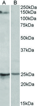 Anti-RBM20 antibody produced in goat affinity isolated antibody, buffered aqueous solution