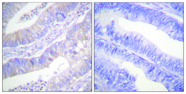 Anti-CFTR antibody produced in rabbit affinity isolated antibody